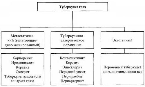 Классификация туберкулеза глаз