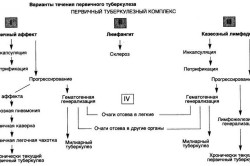 Течение первичного туберкулеза Течение первичного туберкулеза