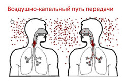 Воздушно-капельный способ передачи туберкулеза