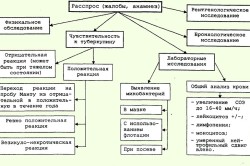 Диагностика туберкулеза Диагностика туберкулеза