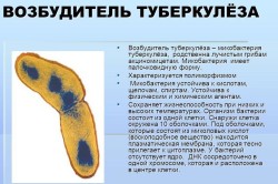 Возбуде