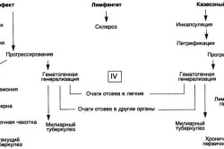 Варианты течения первичного туберкулеза Варианты течения первичного туберкулеза